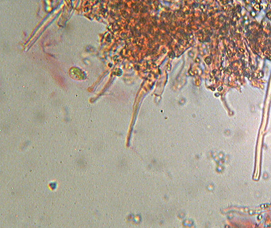 Hyphoderma sambuci
